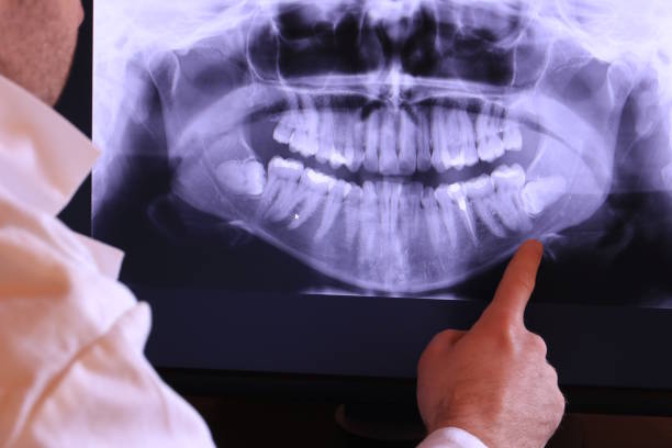 Best Emergency TMJ Treatment in Four Square Mile, CO
