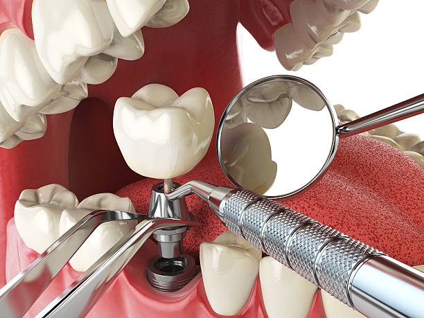 Fast & Reliable Emergency Dental Services in CO